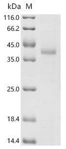 (Tris-Glycine gel) Discontinuous SDS-PAGE (reduced) with 5% enrichment gel and 15% separation gel. Boiling SDS-treated samples may result in membrane protein aggregation. Incubation at 37 centigrade for 10 min is an effective alternative.